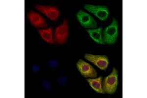 TBCE Antibody staining Hela cells by IF/ICC. (TBCE Antikörper  (N-Term))
