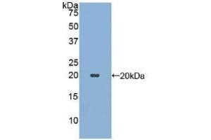 Detection of Recombinant ECP, Human using Polyclonal Antibody to Ecotin (ECO) (Ecotin (AA 21-162) Antikörper)