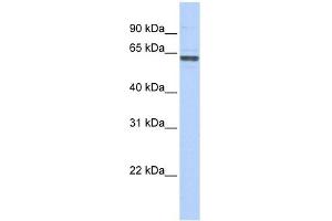 RNMT antibody used at 1 ug/ml to detect target protein. (RNMT Antikörper)