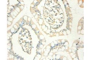 Immunohistochemistry of paraffin-embedded human small intestine tissue using ABIN7159537 at dilution of 1:100 (MT1X Antikörper  (AA 1-59))