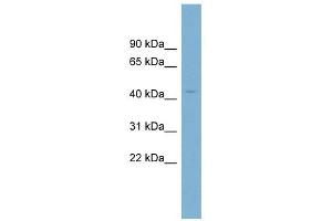 CRBN antibody used at 1 ug/ml to detect target protein. (CRBN Antikörper  (N-Term))