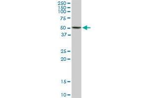 HDAC3 monoclonal antibody (M02), clone 3E11. (HDAC3 Antikörper  (AA 319-428))