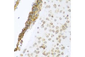 Immunohistochemistry of paraffin-embedded mouse brain using YBX1 antibody. (YBX1 Antikörper)