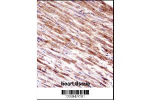 Immunohistochemistry (IHC) image for anti-HSPA Binding Protein, Cytoplasmic Cochaperone 1 (HSPBP1) (AA 69-97), (N-Term) antibody (ABIN5531417)