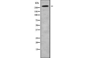 Western blot analysis NAV2 using HeLa whole cell lysates (NAV2 Antikörper  (Internal Region))
