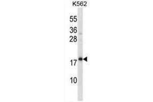 CREG1 Antibody (N-term) western blot analysis in K562 cell line lysates (35µg/lane). (CREG1 Antikörper  (N-Term))