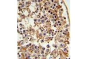 Formalin fixed and paraffin embedded testis tissue reacted with FANCC Antibody (C-term) followed by peroxidase conjugation of the secondary antibody and DAB staining. (FANCC Antikörper  (C-Term))