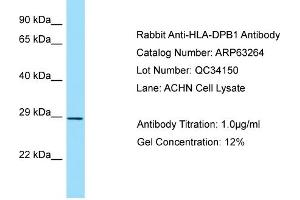 Western Blotting (WB) image for anti-Major Histocompatibility Complex, Class II, DP beta 1 (HLA-DPB1) (Middle Region) antibody (ABIN2789429)