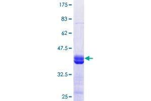 KDM2B Protein (AA 457-555) (GST tag)