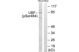 Western blot analysis of extracts from HeLa cells, treated with calyculinA (50 ng/mL, 30 mins), using UBF (Phospho-Ser484) antibody. (UBTF Antikörper  (pSer484))