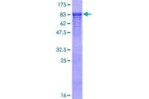 TBL1X Protein (AA 1-526) (GST tag)