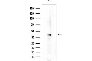 anti-Neutrophil Cytosolic Factor 4, 40kDa (NCF4) (pThr154) antibody