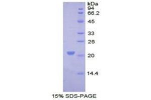 SDS-PAGE (SDS) image for Collagen, Type VIII, alpha 1 (COL8A1) ELISA Kit (ABIN6730964)