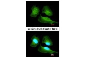 ICC/IF Image Immunofluorescence analysis of methanol-fixed HeLa, using Cullin 7, antibody at 1:200 dilution.