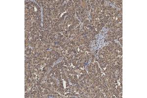 IHC analysis of mSin3A/SIN3A using anti-mSin3A/SIN3A antibody (ABIN7602504). (SIN3A Antikörper  (AA 8-918))