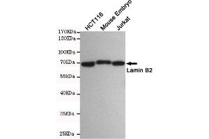 Western blot detection of Lamin B2 in HC, Mouse Embryo and Jurkat cell lysates using Lamin B2 mouse mAb(dilution 1:500). (Lamin B2 Antikörper)