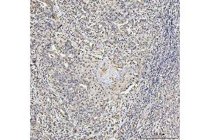 IHC analysis of NCL using anti-NCL antibody (ABIN7600662).