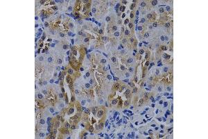 Immunohistochemistry of paraffin-embedded rat kidney using TNFRSF6B antibody at dilution of 1:200 (400x lens). (TNFRSF6B Antikörper)