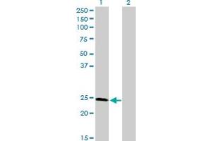 Western Blot analysis of RAD51L3 expression in transfected 293T cell line by RAD51L3 MaxPab polyclonal antibody. (RAD51D Antikörper  (AA 1-216))