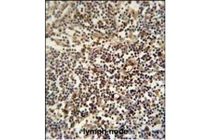 LTM5 antibody (N-term) 10077a immunohistochemistry analysis in formalin fixed and paraffin embedded human lymph node followed by peroxidase conjugation of the secondary antibody and DAB staining. (LAPTM5 Antikörper  (N-Term))