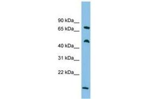 Image no. 1 for anti-Ecdysoneless Homolog (ECD) (C-Term) antibody (ABIN6744684) (ECD/SGT1 Antikörper  (C-Term))
