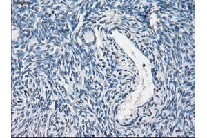 Immunohistochemical staining of paraffin-embedded colon tissue using anti-PPP5Cmouse monoclonal antibody. (PP5 Antikörper)