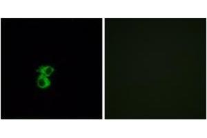 Immunofluorescence analysis of MCF7 cells, using OR6B2 Antibody. (OR6B2 Antikörper  (AA 261-310))