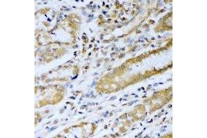 Immunohistochemistry (IHC) image for anti-Proteasome (Prosome, Macropain) Subunit, beta Type, 5 (PSMB5) antibody (ABIN7306068)