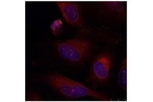 Image no. 2 for anti-Jun B Proto-Oncogene (JUNB) (AA 77-81) antibody (ABIN197138) (JunB Antikörper  (AA 77-81))