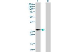 Western Blot analysis of RALB expression in transfected 293T cell line by RALB MaxPab polyclonal antibody. (RALB Antikörper  (AA 1-206))