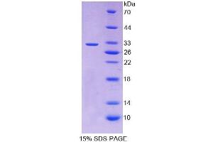 SDS-PAGE (SDS) image for Retinoic Acid Receptor, beta (RARB) (AA 205-451) protein (His tag) (ABIN6237327) (Retinoic Acid Receptor beta Protein (AA 205-451) (His tag))