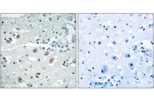 Immunohistochemistry analysis of paraffin-embedded human brain, using PLA2G4D Antibody. (PLA2G4D Antikörper  (AA 531-580))