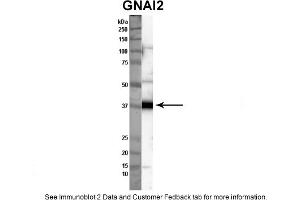 Sample Type: Nthy-ori cell lysate (50ug)Primary Dilution: 1:1000Secondary Antibody: anti-rabbit HRPSecondary Dilution: 1:2000Image Submitted By: Anonymous (GNAI2 Antikörper  (C-Term))
