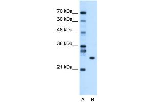 WB Suggested Anti-RBPMS Antibody Titration:  0. (RBPMS Antikörper  (N-Term))