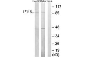 Western blot analysis of extracts from HeLa/HepG2 cells, using IFI16 Antibody.