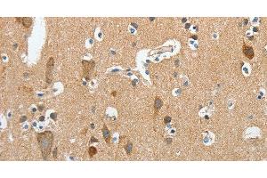 Immunohistochemistry of paraffin-embedded Human brain using DSCR1 Polyclonal Antibody at dilution of 1:45 (RCAN1 Antikörper)