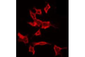 ABIN6272251 staining COLO205 by IF/ICC. (ARRDC4 Antikörper  (Internal Region))