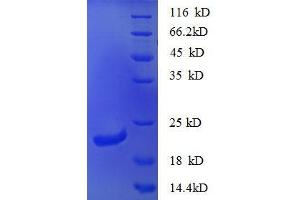 Chemokine (C-X-C Motif) Ligand 16 (CXCL16) (AA 27-198), (partial) protein (His tag) (CXCL16 Protein (AA 27-198, partial) (His tag))