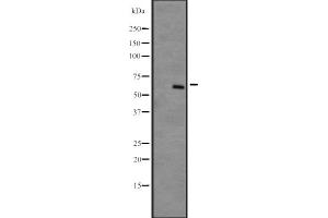 Western blot analysis of DYRK4 expression in NCI-H292 cell line lysates ;developed using the ECL technique,The lane on the left is treated with the antigen-specific peptide. (DYRK4 Antikörper  (C-Term))