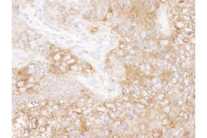 Immunohistochemistry (IHC) image for anti-Eukaryotic Translation Elongation Factor 2 (EEF2) (AA 808-858) antibody (ABIN7448956) (EEF2 Antikörper  (AA 808-858))