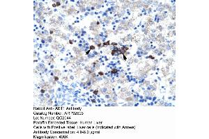 Human kidney (Activator of Basal Transcription 1 Antikörper  (Middle Region))