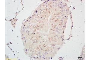 Formalin-fixed and paraffin embedded rat testis labeled with Rabbit Anti PSCA Polyclonal Antibody, Unconjugated (ABIN671676) at 1:200 followed by conjugation to the secondary antibody and DAB staining (PSCA Antikörper  (AA 24-123))
