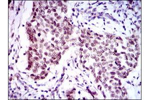 Image no. 1 for anti-Forkhead Box P1 (FOXP1) antibody (ABIN1491561) (FOXP1 Antikörper)