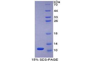 SDS-PAGE (SDS) image for Peptidase Inhibitor 3, Skin-Derived (PI3) (AA 41-117) protein (His tag) (ABIN1080483)