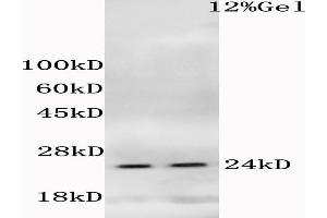 L1 mouse liver, L2 mouse cerebrum lysates probed (ABIN685183) at 1:200 in 4 °C. (HIST1H1E Antikörper  (pThr18))