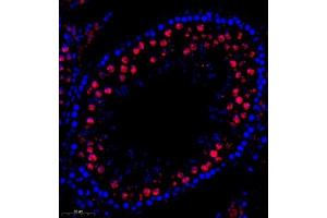 Immunofluorescence of paraffin embedded rat testis using QSK (ABIN7075608) at dilution of 1:600 (300x lens) (SIK3 Antikörper)