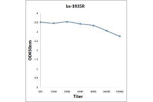 Antigen: 0. (SCGB1A1 Antikörper  (AA 51-96))
