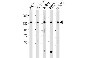 All lanes : Anti-TACC3 Antibody (Center) at 1:2000 dilution Lane 1: A431 whole cell lysate Lane 2: HC whole cell lysate Lane 3: Jurkat whole cell lysate Lane 4: K562 whole cell lysate Lane 5: U-2OS whole cell lysate Lysates/proteins at 20 μg per lane. (TACC3 Antikörper  (AA 317-350))
