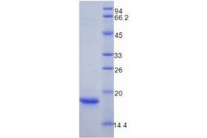 SDS-PAGE analysis of Mouse Myoglobin Protein. (Myoglobin Protein (MB))