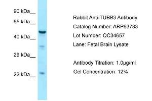 Western Blotting (WB) image for anti-Tubulin, beta 3 (TUBB3) (C-Term) antibody (ABIN2774381) (TUBB3 Antikörper  (C-Term))